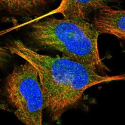 NARG1 Antibody, Novus Biologicals 0.1mL; Unlabeled:Antibodies, Polyclonal